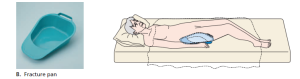 (B) A fracture pan. Position a fracture pan with the thin edge toward the head of the bed.