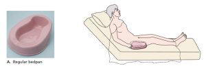 (A) A standard bedpan. Position a standard bedpan like a regular toilet seat—the buttocks are placed on the wide, rounded shelf, with the open end pointed toward the foot of the bed.